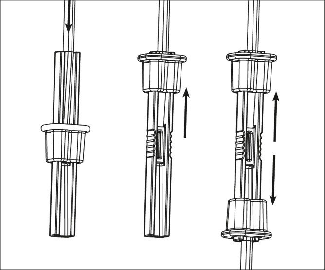 AKO Litzclip® Reparaturset für Netz-Vertikalstreben